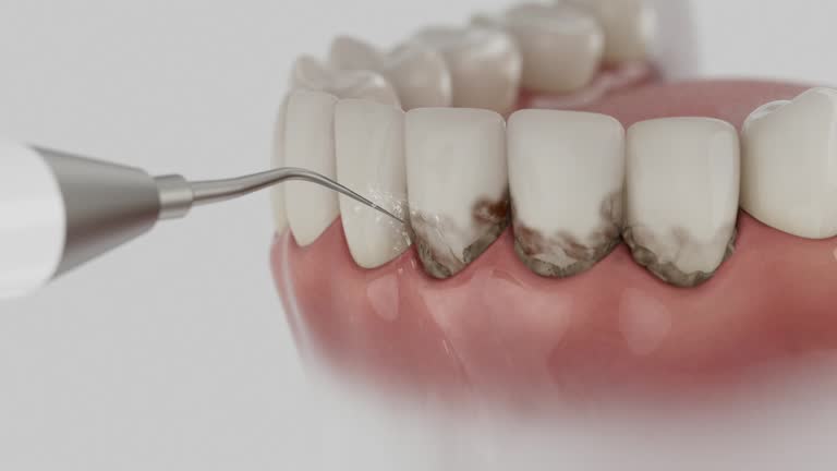 Reliable Tooth Extraction contractor in Stockton, KS by Smile Center Dentistry